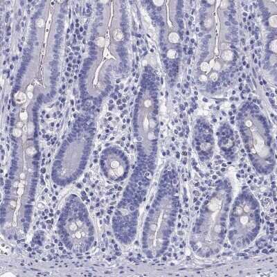 Immunohistochemistry-Paraffin: CYB5R2 Antibody [NBP2-62636]