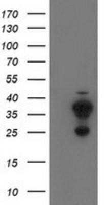 Western Blot: CYB5R2 Antibody (OTI4B9)Azide and BSA Free [NBP2-71942]