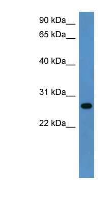 Western Blot: CYB5R2 Antibody [NBP1-79540]