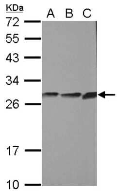 Western Blot: CYB5R2 Antibody [NBP2-16048]