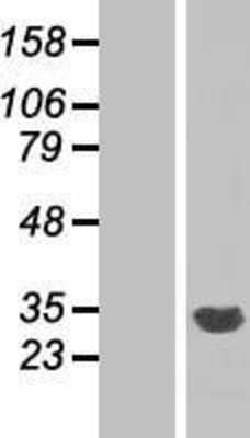 Western Blot: CYB5R2 Overexpression Lysate [NBP2-07068]