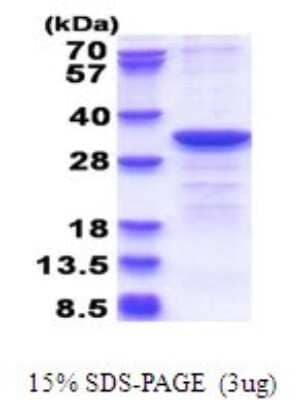 SDS-PAGE: Recombinant Human CYB5R2 His Protein [NBP2-51692]