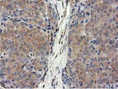 Immunohistochemistry-Paraffin: CYB5R3 Antibody (OTI2A10) [NBP2-02705]