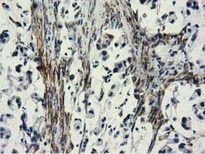 Immunohistochemistry-Paraffin: CYB5R3 Antibody (OTI2A10) [NBP2-02705]
