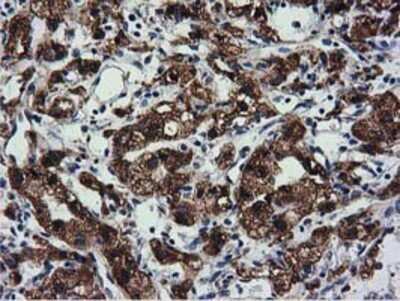 Immunohistochemistry-Paraffin: CYB5R3 Antibody (OTI2A10) [NBP2-02705]