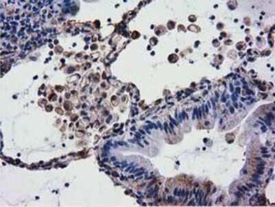 Immunohistochemistry-Paraffin: CYB5R3 Antibody (OTI2A10) [NBP2-02705]