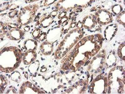 Immunohistochemistry-Paraffin: CYB5R3 Antibody (OTI2A10) [NBP2-02705]