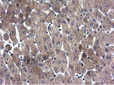 Immunohistochemistry-Paraffin: CYB5R3 Antibody (OTI2A10) [NBP2-02705]