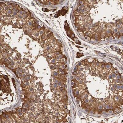 Immunohistochemistry-Paraffin: CYB5R3 Antibody [NBP1-84252]
