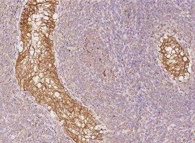 Immunohistochemistry-Paraffin: CYB5R3 Antibody [NBP3-06497]