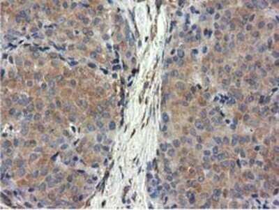 Immunohistochemistry: CYB5R3 Antibody (OTI2A10) - Azide and BSA Free [NBP2-70572]