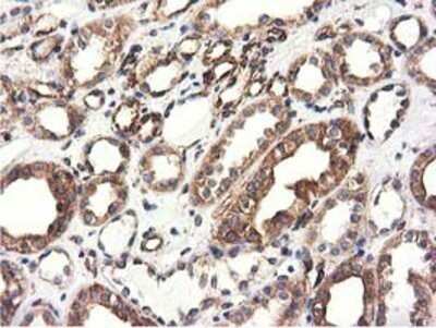 Immunohistochemistry: CYB5R3 Antibody (OTI2A10) - Azide and BSA Free [NBP2-70572]