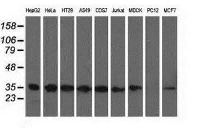 Western Blot: CYB5R3 Antibody (OTI2A10)Azide and BSA Free [NBP2-70572]