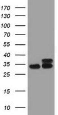 Western Blot: CYB5R3 Antibody (OTI2A10)Azide and BSA Free [NBP2-70572]