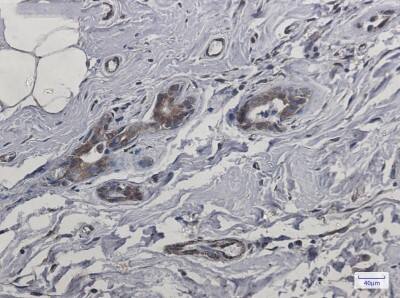 Immunohistochemistry-Paraffin: CYB5R3 Antibody (S01-9F3) [NBP3-19614]