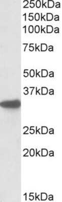 Western Blot: CYB5R3 Antibody [NBP1-51984]