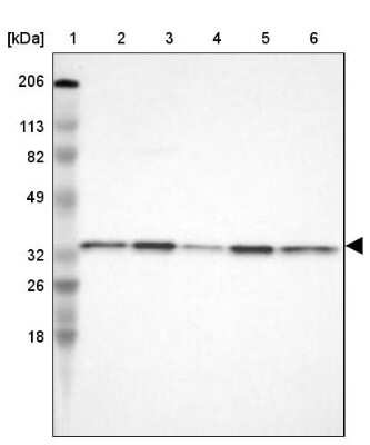 Western Blot: CYB5R3 Antibody [NBP1-84252]