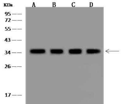 Western Blot: CYB5R3 Antibody [NBP3-06497]