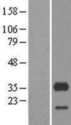 Western Blot: CYB5R3 Overexpression Lysate [NBL1-09654]