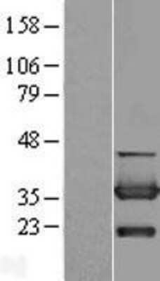 Western Blot: CYB5R3 Overexpression Lysate [NBL1-09655]