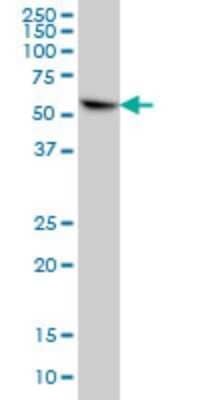 Western Blot: CYB5R4 Antibody (1E8) [H00051167-M01]