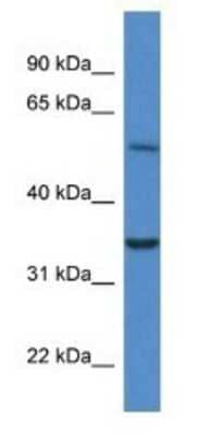 Western Blot: CYB5R4 Antibody [NBP1-74118]