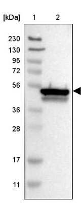 Western Blot: CYB5R4 Antibody [NBP1-88957]