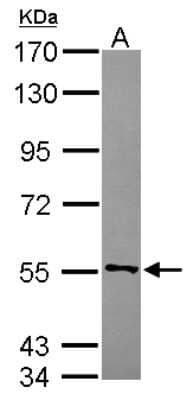 Western Blot: CYB5R4 Antibody [NBP2-16049]