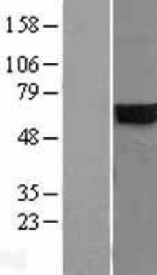 Western Blot: CYB5R4 Overexpression Lysate [NBL1-09656]