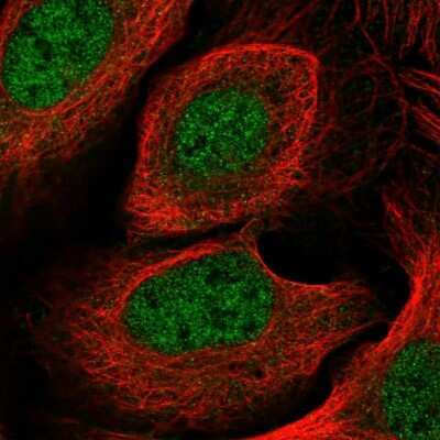 Immunocytochemistry/ Immunofluorescence: CYB5RL Antibody [NBP2-13889]