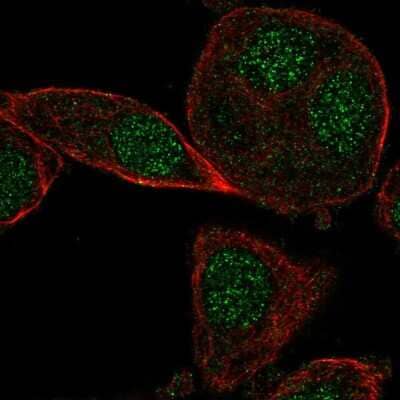 Immunocytochemistry/ Immunofluorescence: CYB5RL Antibody [NBP2-56471]