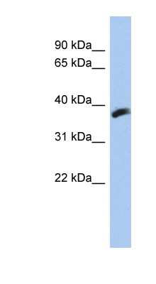 Western Blot: CYB5RL Antibody [NBP1-79619]