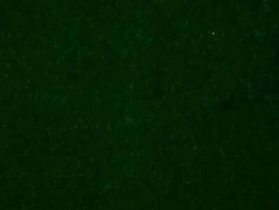 Immunohistochemistry: CYBB/NOX2 Antibody - BSA Free [NBP2-41291]