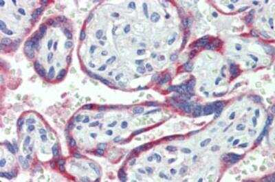 Immunohistochemistry-Paraffin: CYBB/NOX2 Antibody [NBP1-51928]