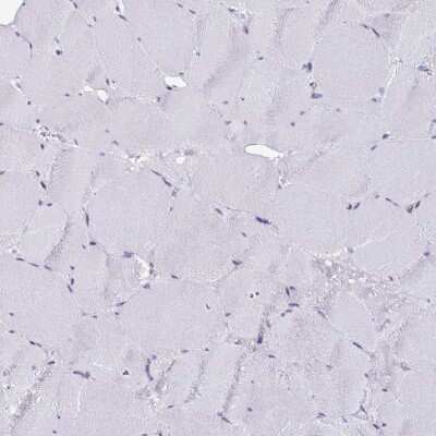 Immunohistochemistry-Paraffin: CYBB/NOX2 Antibody [NBP2-38642]