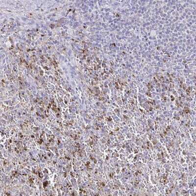 Immunohistochemistry-Paraffin: CYBB/NOX2 Antibody [NBP2-38642]