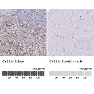 Immunohistochemistry-Paraffin: CYBB/NOX2 Antibody [NBP2-38642]