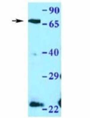 Western Blot: CYBB/NOX2 Antibody [NBP1-59062]