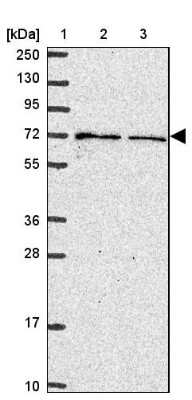 Western Blot: CYBB/NOX2 Antibody [NBP2-38642]