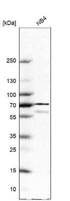 Western Blot: CYBB/NOX2 Antibody [NBP2-38642]