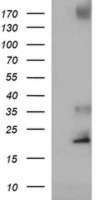 Western Blot: CYBC1 Antibody (OTI3B5)Azide and BSA Free [NBP2-72205]