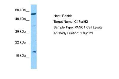 Western Blot: CYBC1 Antibody [NBP2-84744]