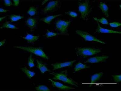 Immunocytochemistry/ Immunofluorescence: CYC1 Antibody [H00001537-B01P]