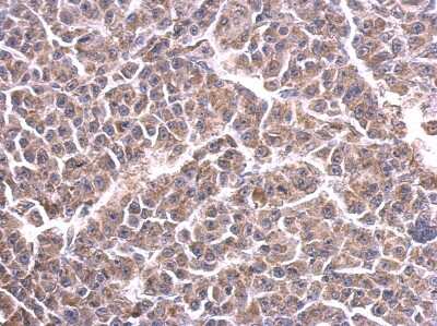 Immunohistochemistry-Paraffin: CYC1 Antibody [NBP1-32072]
