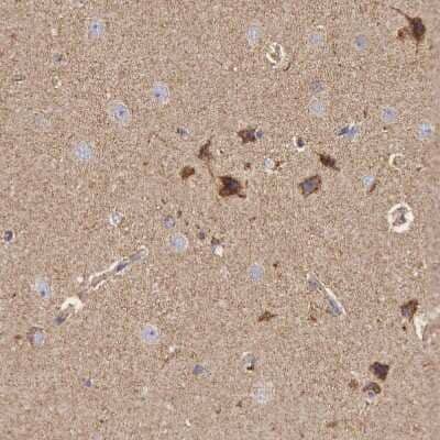 Immunohistochemistry-Paraffin: CYC1 Antibody [NBP1-86872]