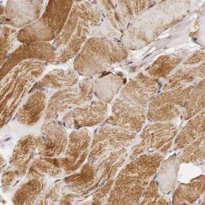 Immunohistochemistry-Paraffin: CYC1 Antibody [NBP1-86872]