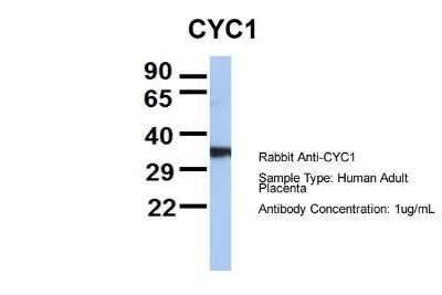 Western Blot: CYC1 Antibody [NBP1-54770]