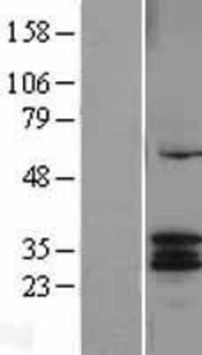 Western Blot: CYC1 Overexpression Lysate [NBL1-09661]