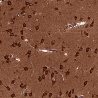 Immunohistochemistry: CYFIP1 Antibody [NBP2-49545]