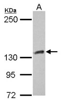 Western Blot: CYFIP1 Antibody [NBP2-16060]